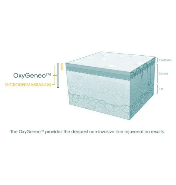 Oxygeno